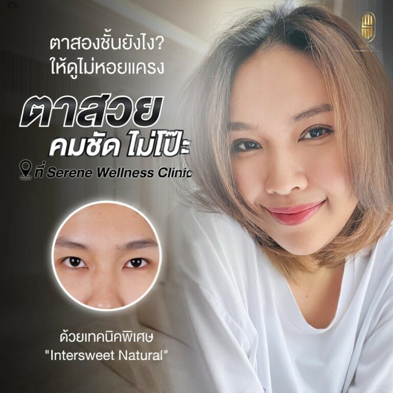 LINE_ALBUM_Review _ Ads_๒๓๐๒๐๖_0