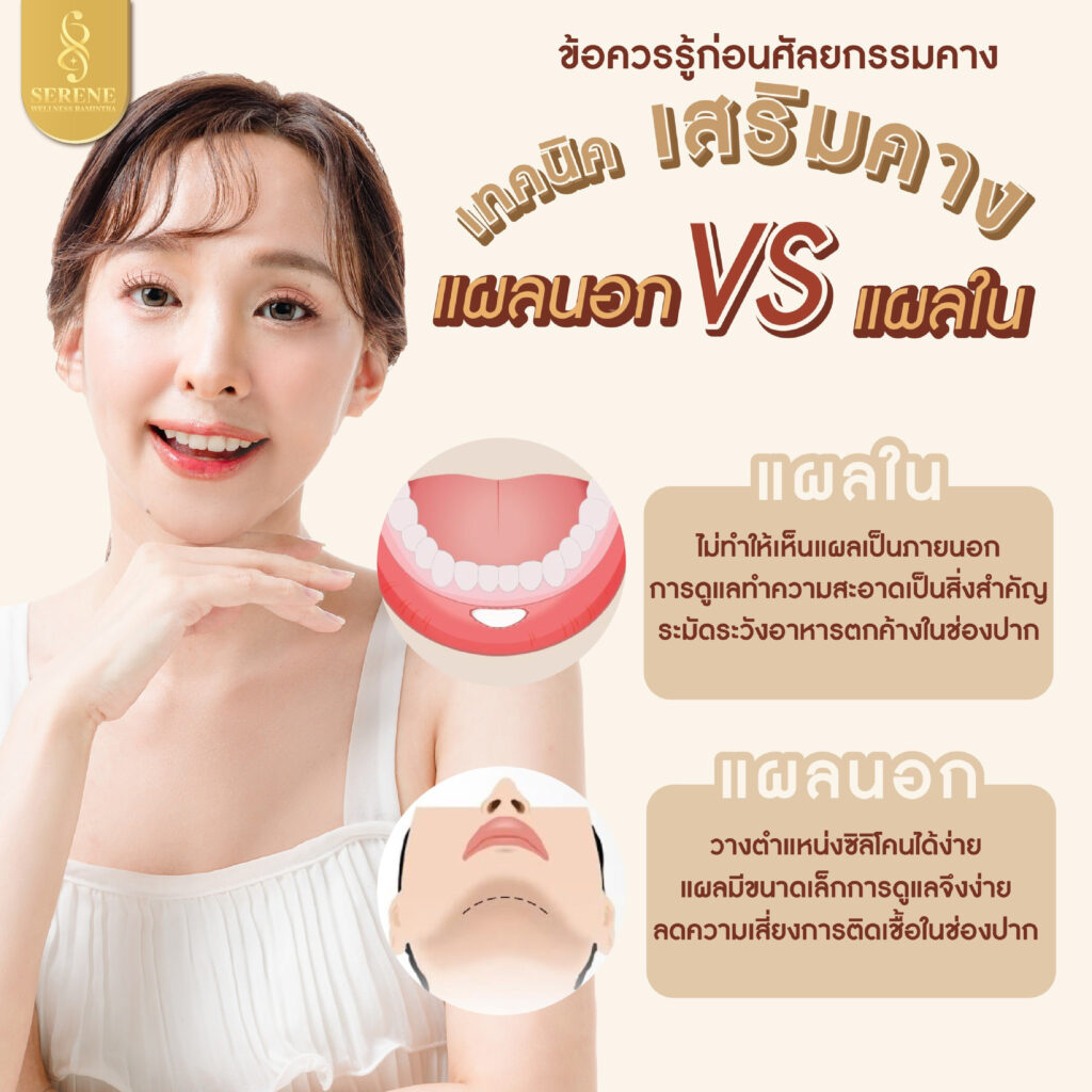 บทความ 03 1