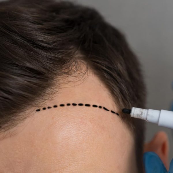 Hands Specialist Gloves Make Marks Forehead Man