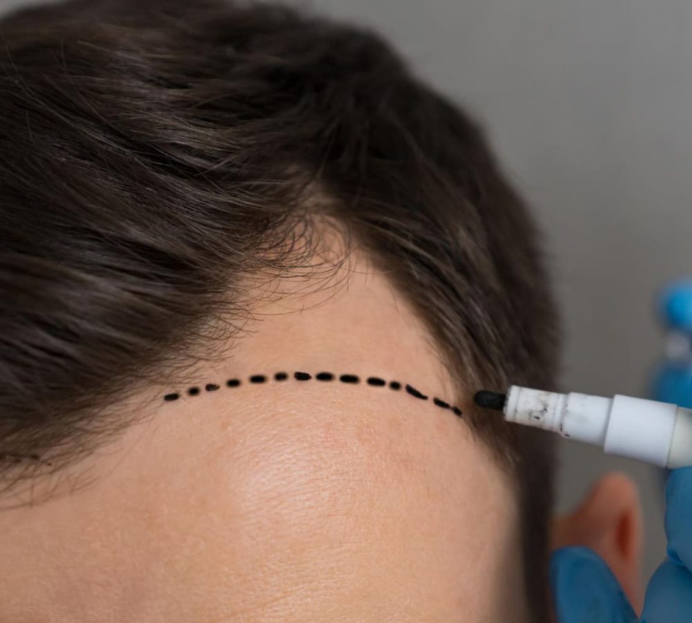Hands Specialist Gloves Make Marks Forehead Man